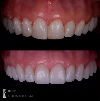 Snapinsta.app_279626914_295446962741636_3005772856155692579_n_1080